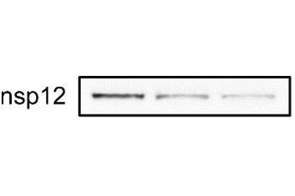 SARS-CoV-2 NSP12 (RdRP) anticorps  (C-Term)