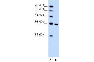 Image no. 1 for anti-Solute Carrier Family 25, Member 29 (SLC25A29) (C-Term) antibody (ABIN630313)