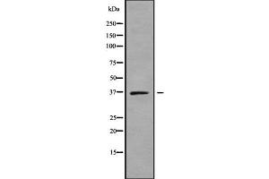 anti-Solute Carrier Family 25 (Mitochondrial Carrier, Brain), Member 14 (SLC25A14) (Internal Region) antibody