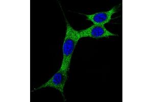 Image no. 5 for anti-Microtubule-Associated Protein 1 Light Chain 3 alpha (MAP1LC3A) (AA 89-120), (cleaved) antibody (ABIN388483)