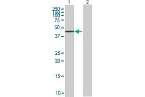 anti-Zinc Finger Protein 157 (ZNF157) (AA 1-506) antibody