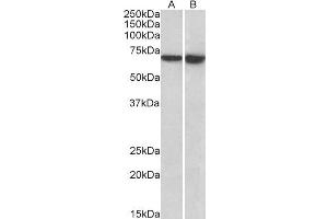 Image no. 1 for anti-Lymphocyte Cytosolic Protein 1 (LCP1) (AA 277-291) antibody (ABIN2613446)