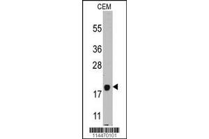 Image no. 1 for anti-Pro-Platelet Basic Protein (Chemokine (C-X-C Motif) Ligand 7) (PPBP) (AA 97-128), (C-Term) antibody (ABIN391801)