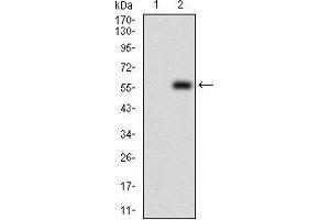 Image no. 5 for anti-DIS3-Like Exonuclease 2 (DIS3L2) (AA 27-250) antibody (ABIN1724900)