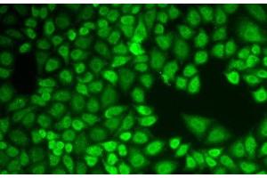 Immunofluorescence analysis of HeLa cells using CTSD Polyclonal Antibody