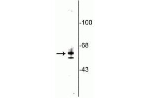 Image no. 2 for anti-Nuclear Receptor Subfamily 2, Group C, Member 1 (NR2C1) (N-Term) antibody (ABIN361367)