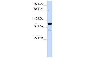 Image no. 1 for anti-Transmembrane Protein 38A (TMEM38A) (N-Term) antibody (ABIN635479)