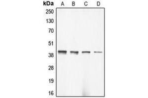 Image no. 1 for anti-Actin, gamma 2, Smooth Muscle, Enteric (ACTG2) (N-Term) antibody (ABIN2707325)