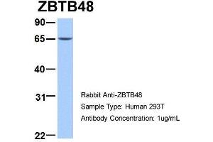 Image no. 1 for anti-Zinc Finger and BTB Domain Containing 48 (ZBTB48) (N-Term) antibody (ABIN1109543)