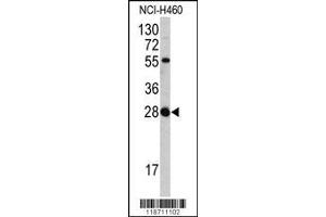Image no. 1 for anti-Fibroblast Growth Factor 18 (FGF18) (AA 23-50), (N-Term) antibody (ABIN390583)