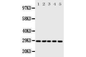 Image no. 1 for anti-Stratifin (SFN) (AA 140-156), (Middle Region) antibody (ABIN3044182)