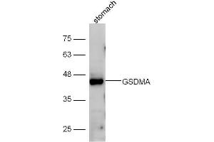 Image no. 4 for anti-Gasdermin A (GSDMA) (AA 21-120) antibody (ABIN2559502)