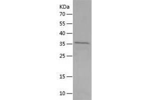MSI2 Protein (AA 1-328) (His tag)
