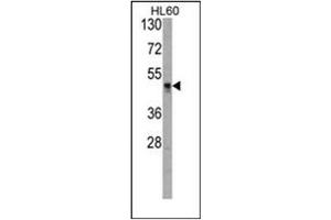 Image no. 1 for anti-Histone Acetyltransferase 1 (HAT1) (AA 35-65), (N-Term) antibody (ABIN356620)