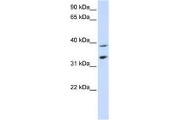 anti-Solute Carrier Family 25, Member 34 (SLC25A34) (C-Term) antibody