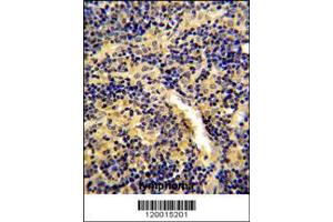 Image no. 2 for anti-Malignant T Cell Amplified Sequence 1 (MCTS1) (AA 1-30), (N-Term) antibody (ABIN390599)