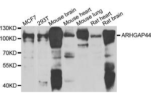 Image no. 1 for anti-rho GTPase Activating Protein 44 (ARHGAP44) antibody (ABIN6571090)