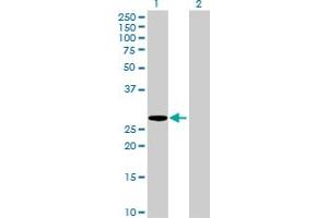 Image no. 1 for anti-Major Histocompatibility Complex, Class II, DM alpha (HLA-DMA) (AA 1-261) antibody (ABIN516470)