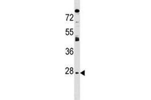 Image no. 1 for anti-Aquaporin 1 (Colton Blood Group) (AQP1) (AA 241-269) antibody (ABIN3030000)
