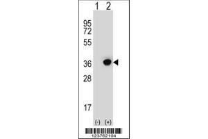 Image no. 2 for anti-Dehydrogenase/reductase (SDR Family) Member 3 (DHRS3) (AA 85-113) antibody (ABIN653135)