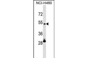 IRX6 Antibody (Center) (ABIN1538203 and ABIN2850242) western blot analysis in NCI- cell line lysates (35 μg/lane).