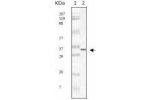 Image no. 1 for anti-SARS-Coronavirus Membrane Protein (SARS-CoV M) antibody (ABIN1502334)