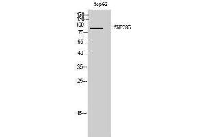 Image no. 1 for anti-Zinc Finger Protein 785 (ZNF785) (Internal Region) antibody (ABIN3187570)