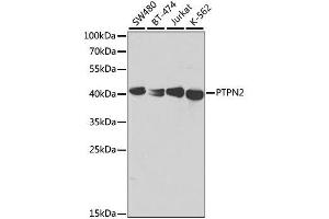 Image no. 3 for anti-Protein tyrosine Phosphatase, Non-Receptor Type 2 (PTPN2) antibody (ABIN3022585)