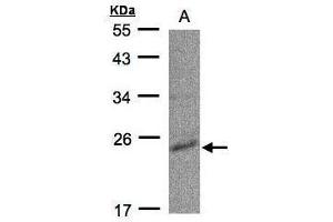 Image no. 2 for anti-Cytidine Monophosphate (UMP-CMP) Kinase 1, Cytosolic (CMPK1) (Center) antibody (ABIN2856126)