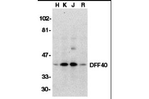 Image no. 1 for anti-DNA Fragmentation Factor, 40kDa, beta Polypeptide (Caspase-Activated DNase) (DFFB) (Middle Region) antibody (ABIN1030918)
