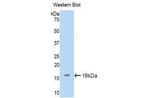 Image no. 1 for anti-Cubilin (Intrinsic Factor-Cobalamin Receptor) (CUBN) (AA 3511-3623) antibody (ABIN1858562)