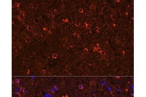 Immunofluorescence analysis of Rat brain using GAD2 Polyclonal Antibody at dilution of 1:100 (40x lens).