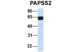 Image no. 3 for anti-3'-phosphoadenosine 5'-phosphosulfate Synthase 2 (PAPSS2) (C-Term) antibody (ABIN2783448)