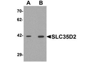 Image no. 2 for anti-Solute Carrier Family 35 (UDP-GlcNAc/UDP-Glucose Transporter), Member D2 (SLC35D2) (C-Term) antibody (ABIN1450067)