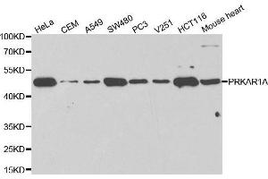 anti-Protein Kinase, CAMP-Dependent, Regulatory, Type I, alpha (Tissue Specific Extinguisher 1) (PRKAR1A) antibody