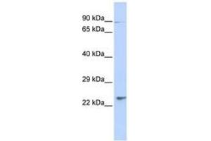 Image no. 1 for anti-Leucine Rich Transmembrane and 0-Methyltransferase Domain Containing (LRTOMT) (N-Term) antibody (ABIN6741334)