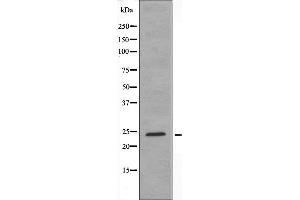 Western blot analysis of extracts from COLO205 cells using HOXA7 antibody.