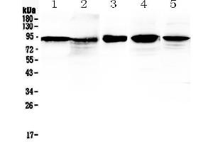 Image no. 7 for anti-Catenin (Cadherin-Associated Protein), beta 1, 88kDa (CTNNB1) (AA 2-233) antibody (ABIN5518980)
