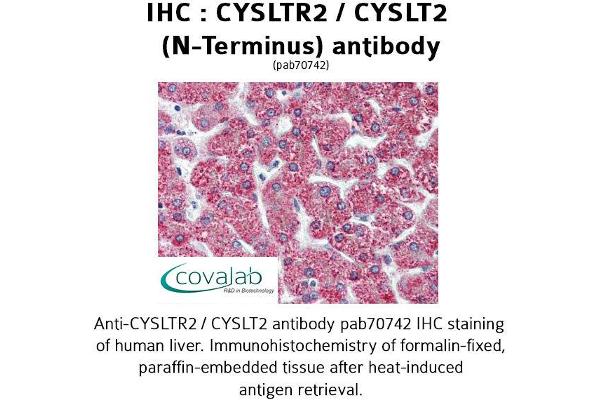 anti-Cysteinyl Leukotriene Receptor 2 (CYSLTR2) (N-Term) antibody