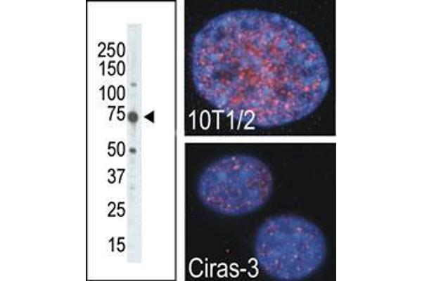 anti-Ribosomal Protein S6 Kinase A4 (RPS6KA4) (AA 322-354), (C-Term) antibody