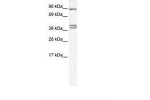 Image no. 1 for anti-Chloride Channel Kb (CLCNKB) (C-Term) antibody (ABIN6735456)