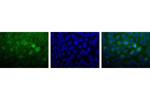 Image no. 2 for anti-Nudix (Nucleoside Diphosphate Linked Moiety X)-Type Motif 1 (NUDT1) (C-Term) antibody (ABIN363382)