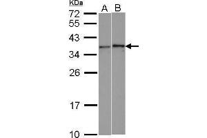 Image no. 1 for anti-Williams Beuren Syndrome Chromosome Region 22 (WBSCR22) (Center) antibody (ABIN2856201)