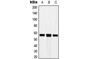 Image no. 1 for anti-Cytochrome P450, Family 3, Subfamily A, Polypeptide 7 (CYP3A7) (Center) antibody (ABIN2705997)