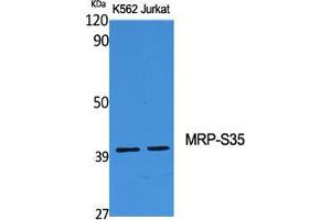 Image no. 2 for anti-Mitochondrial Ribosomal Protein S35 (MRPS35) (Internal Region) antibody (ABIN3185685)
