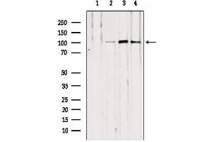 Image no. 2 for anti-Nucleotide-Binding Oligomerization Domain Containing 2 (NOD2) (N-Term) antibody (ABIN6263679)
