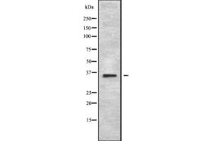 MAGEA2B antibody  (C-Term)