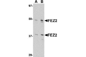 Image no. 1 for anti-Fasciculation and Elongation Protein zeta 2 (Zygin II) (FEZ2) (Middle Region) antibody (ABIN1030932)