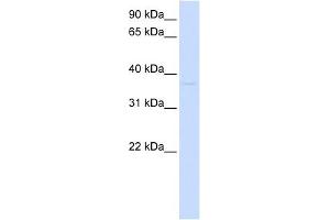 GDAP1L1 抗体  (N-Term)
