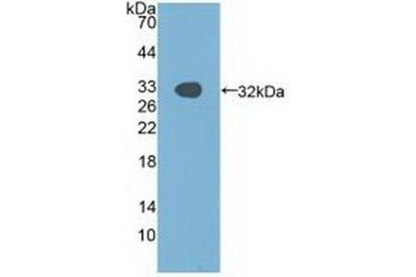 PAK1 Antikörper  (AA 252-501)